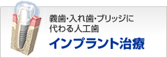 インプラント治療の基礎知識